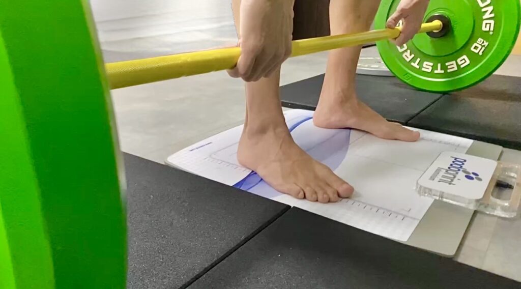 podología deportiva